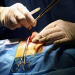 Iranianas fazem cirurgias estéticas para ter oportunidades - 09/04/2025 - Equilíbrio